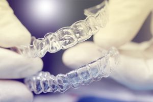 Behandlungsspektrum - Unsichtbare Zahnspange - Invisalign®, Clear Aligner® – die attraktive Alternative zur traditionellen ZahnspangeBehandlungsspektrum |