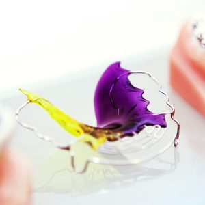 Behandlungsspektrum - Retention - Retainer zur langfristigen Stabilisierung der Zähne und Nachsorge