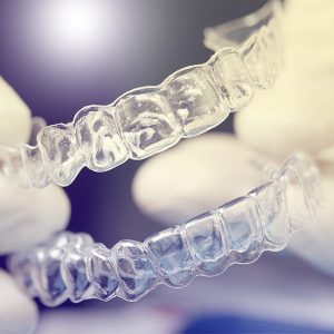 Behandlungsspektrum - Unsichtbare Zahnspange - Invisalign®, Clear Aligner® – die attraktive Alternative zur traditionellen Zahnspange