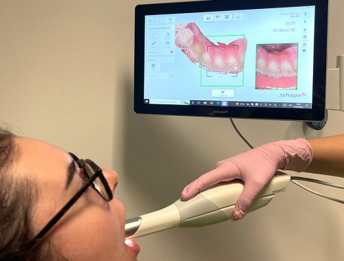 News - Digitaler Zahnabdruck mit unserem 3D-Scanner